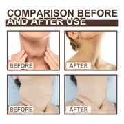 Before and After Use of Lymph Repair Cream