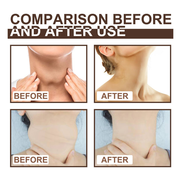 Before and After Use of Lymph Repair Cream