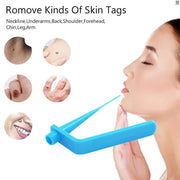 Remove Skin Tags from Neck, Face & Arms – Before & After