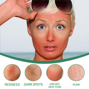 Color correcting cream for redness and dark spots