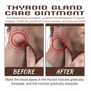 Thyroid Gland Care Ointment Application on Neck