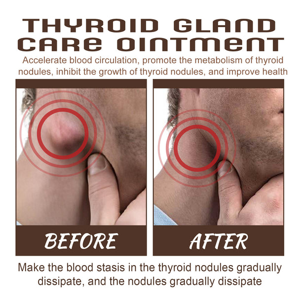Thyroid Gland Care Ointment Application on Neck